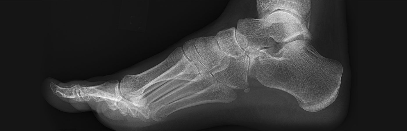 Foot Assessments & Orthotics